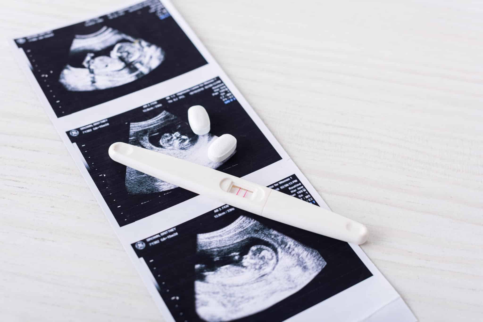 pregnancy test on ultrasound image