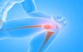 Simple Steps to Support Joint Health at Any Age