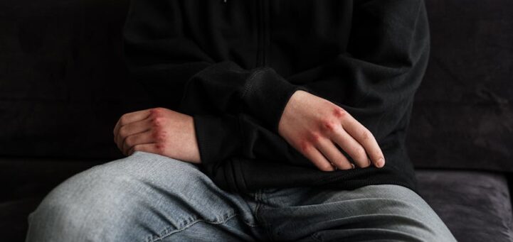 Why Timely Reporting Matters in Personal Injury Claims